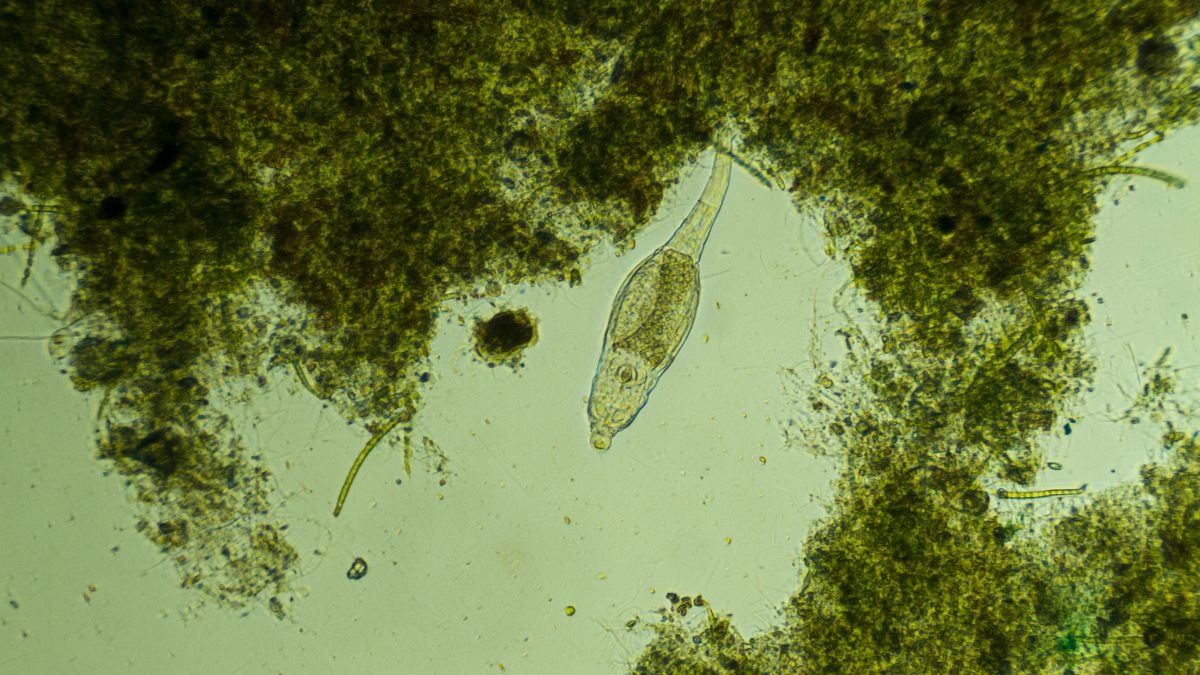 Mikroszkópos kép egy talajban élő mikroorganizmusokról, zöld algákkal és szerves anyagokkal körülvéve.